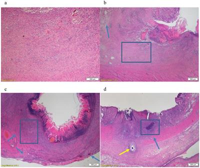 The effects of tranexamic acid on the histopathology of defect healing in an in vivo porcine model after gastric and colonic endoscopic submucosal dissection